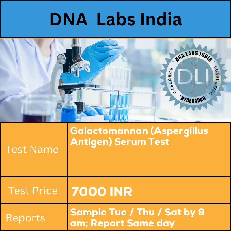 Galactomannan (Aspergillus Antigen) Serum Test Cost in India