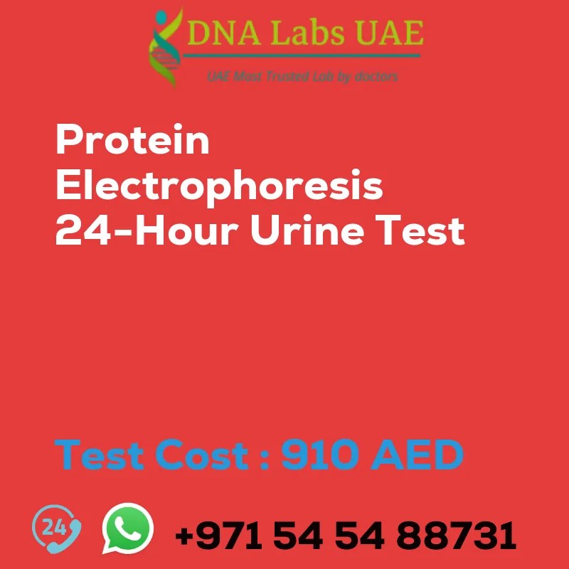 Protein Electrophoresis 24Hour Urine Test Cost in Dubai UAE
