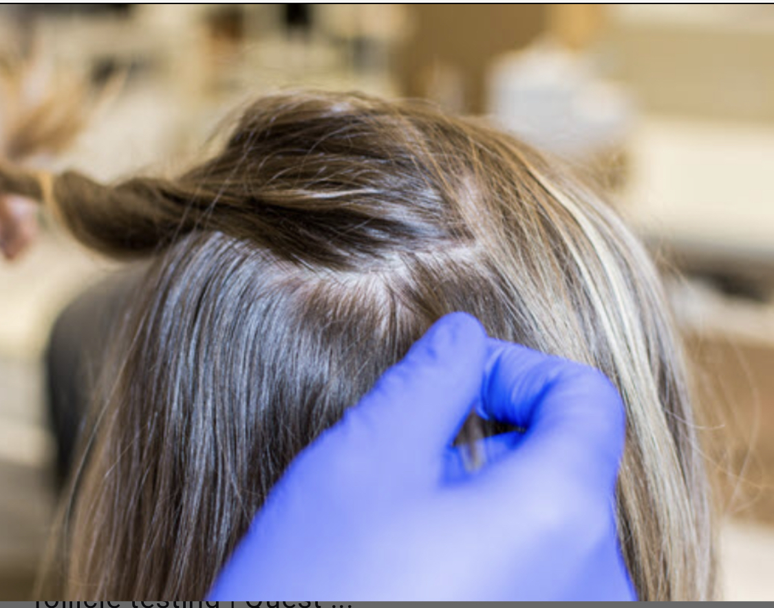 Hair Follicle Drug Testing Facts & Myths DNASU