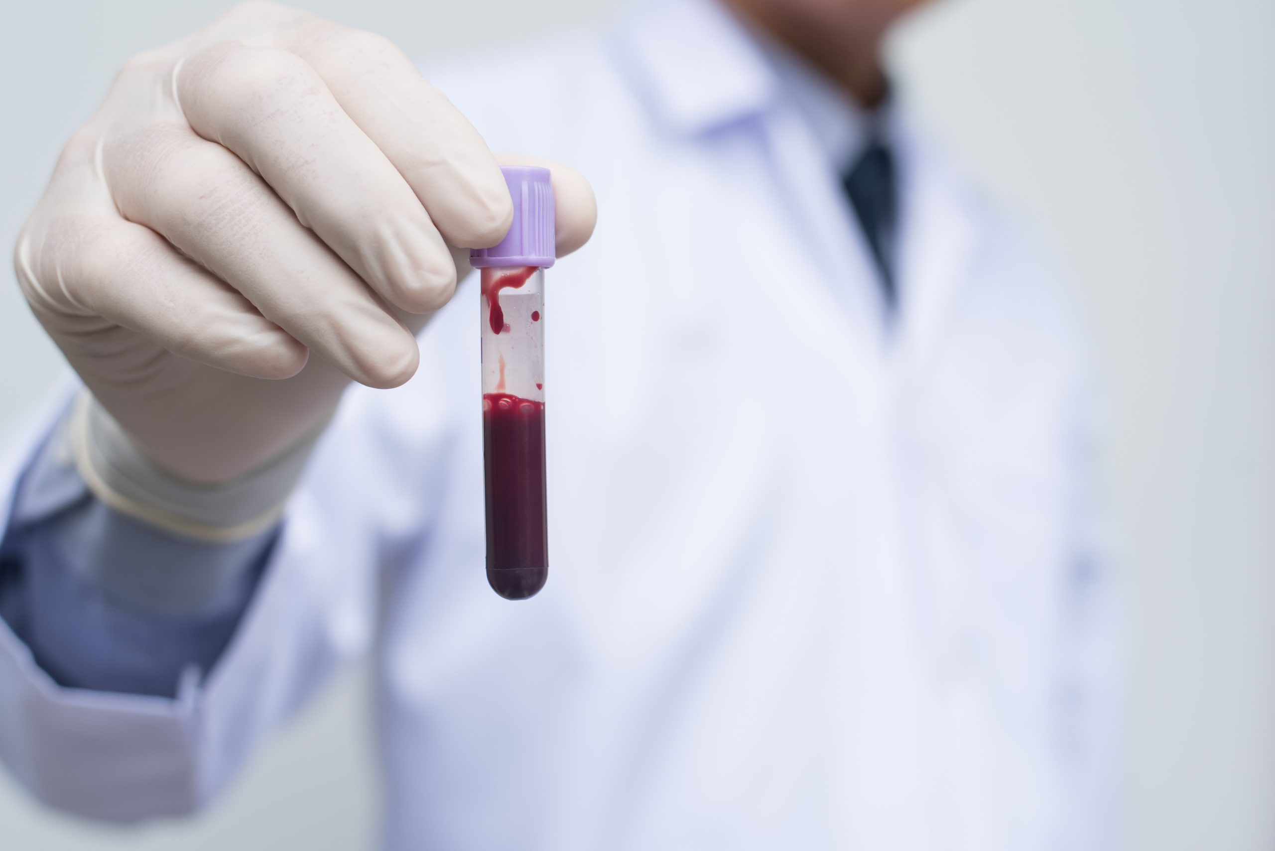 Whole Blood DNA Test DNA Testing Centre