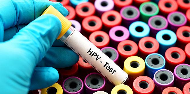 Infectia Cu Hpv Simptome Cauze Investigatii Si Tratament