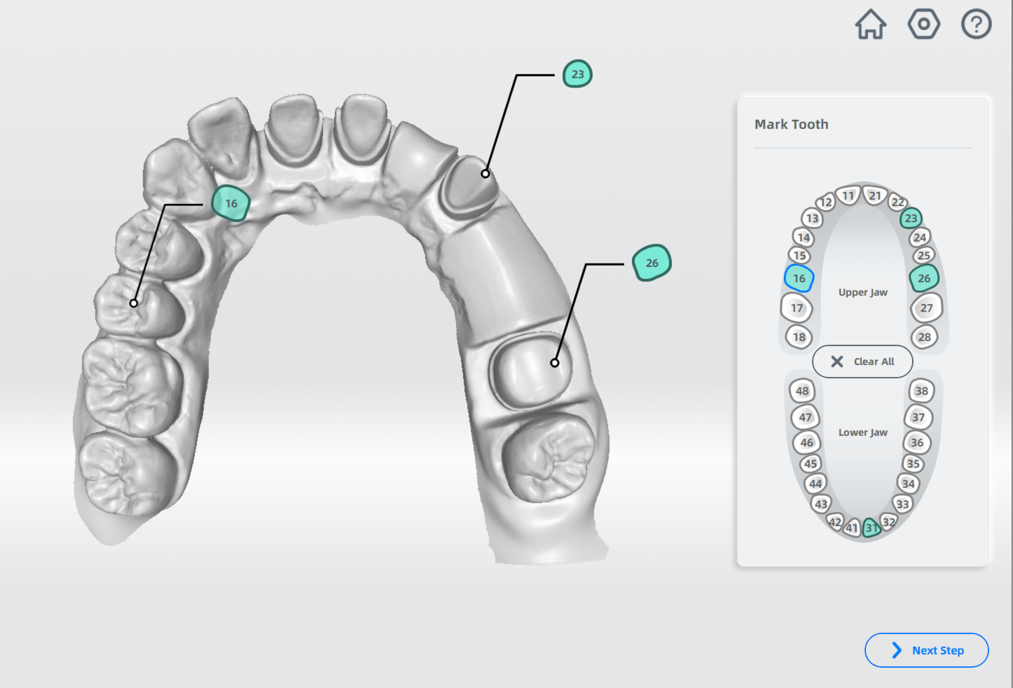 Mark tooth AccuDesign