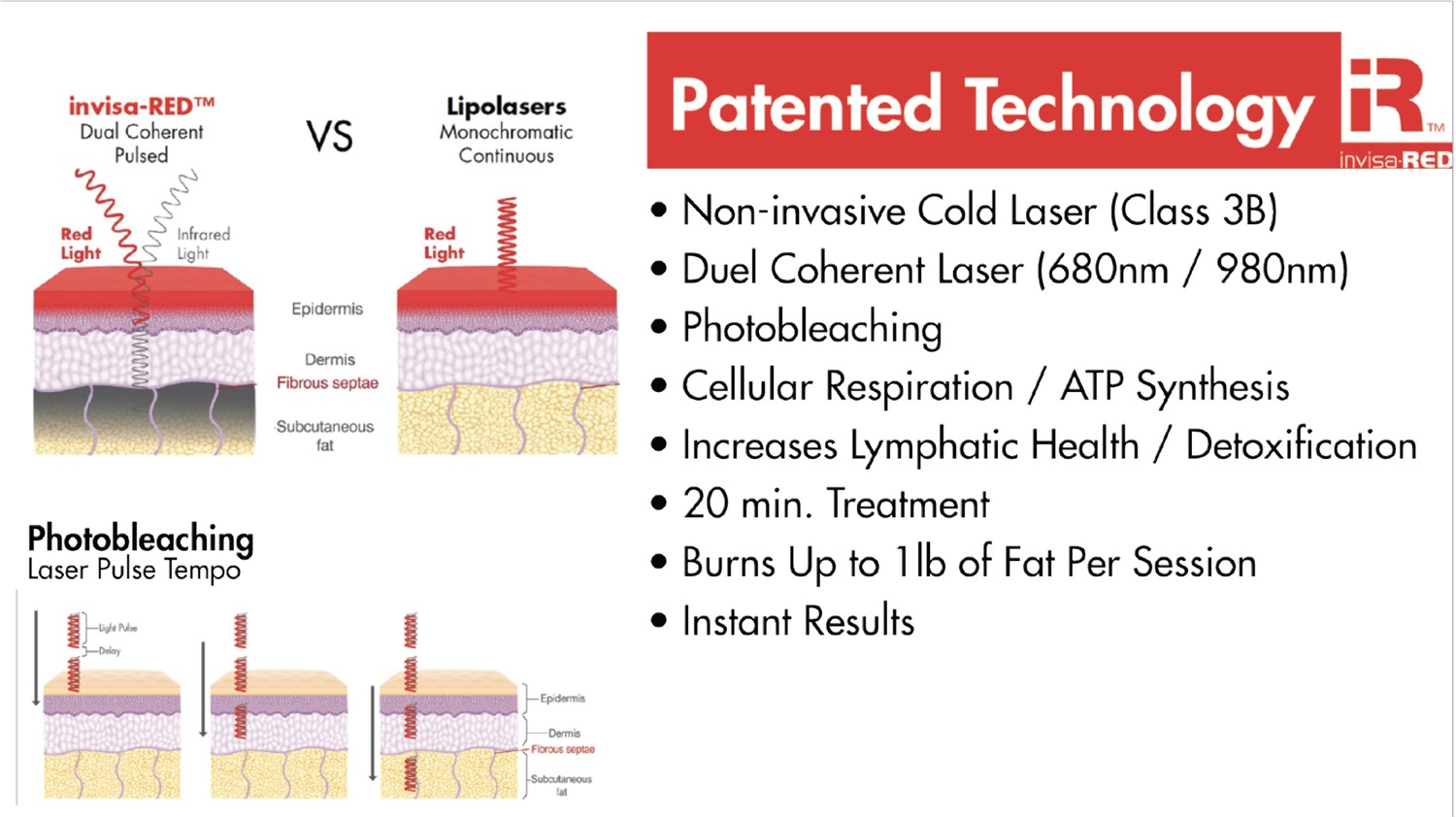 invisaRED Laser Columbia City IN Whitley Chiropractic