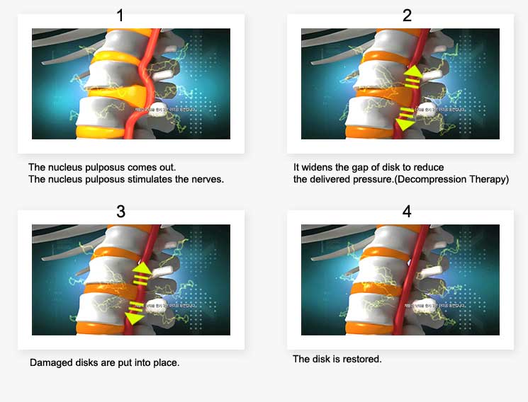 Spinal East Ocean Chiropractic Centre