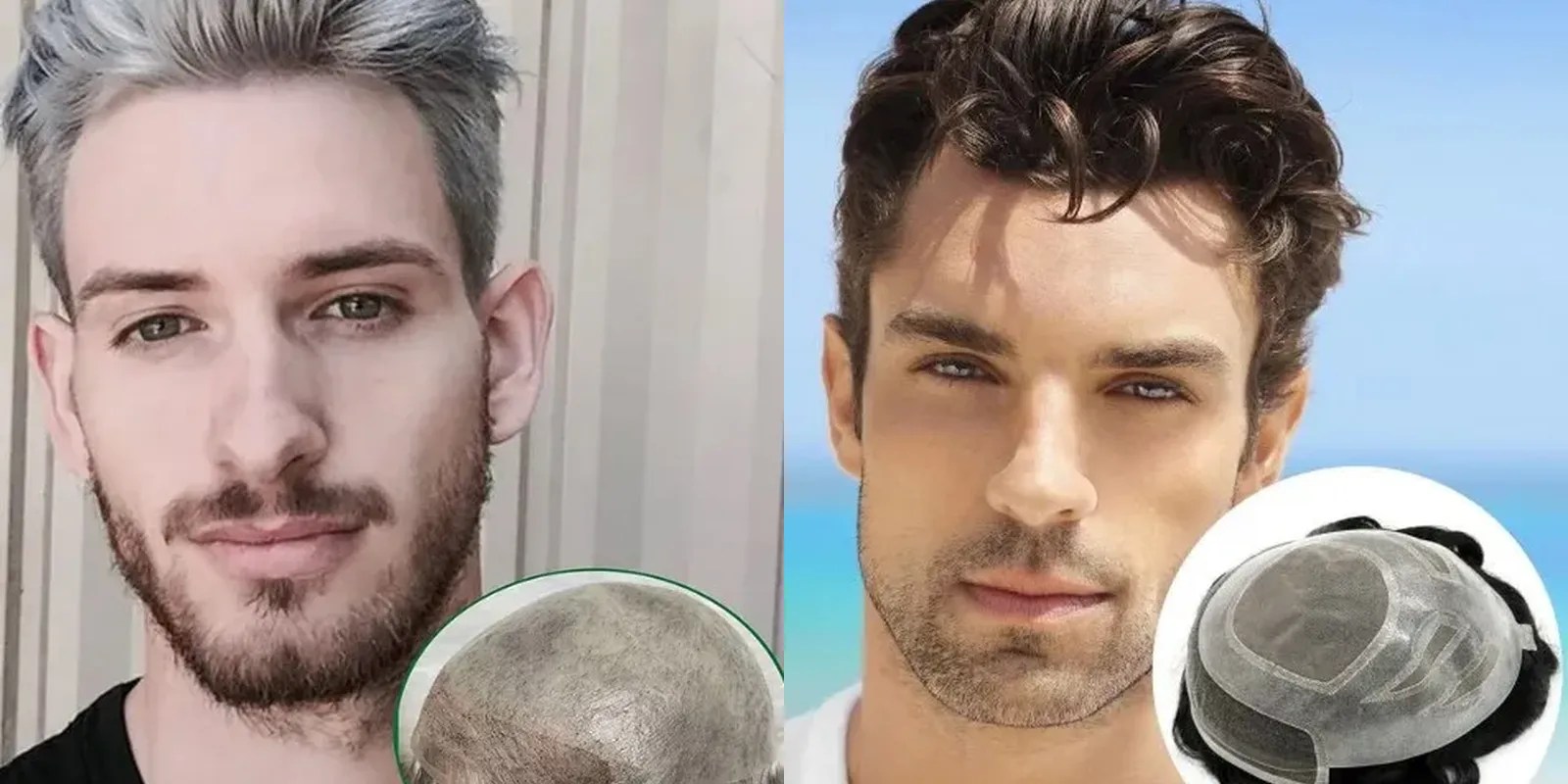 Guide to Buy A Hair Replacement System in Singapore and US Hair System