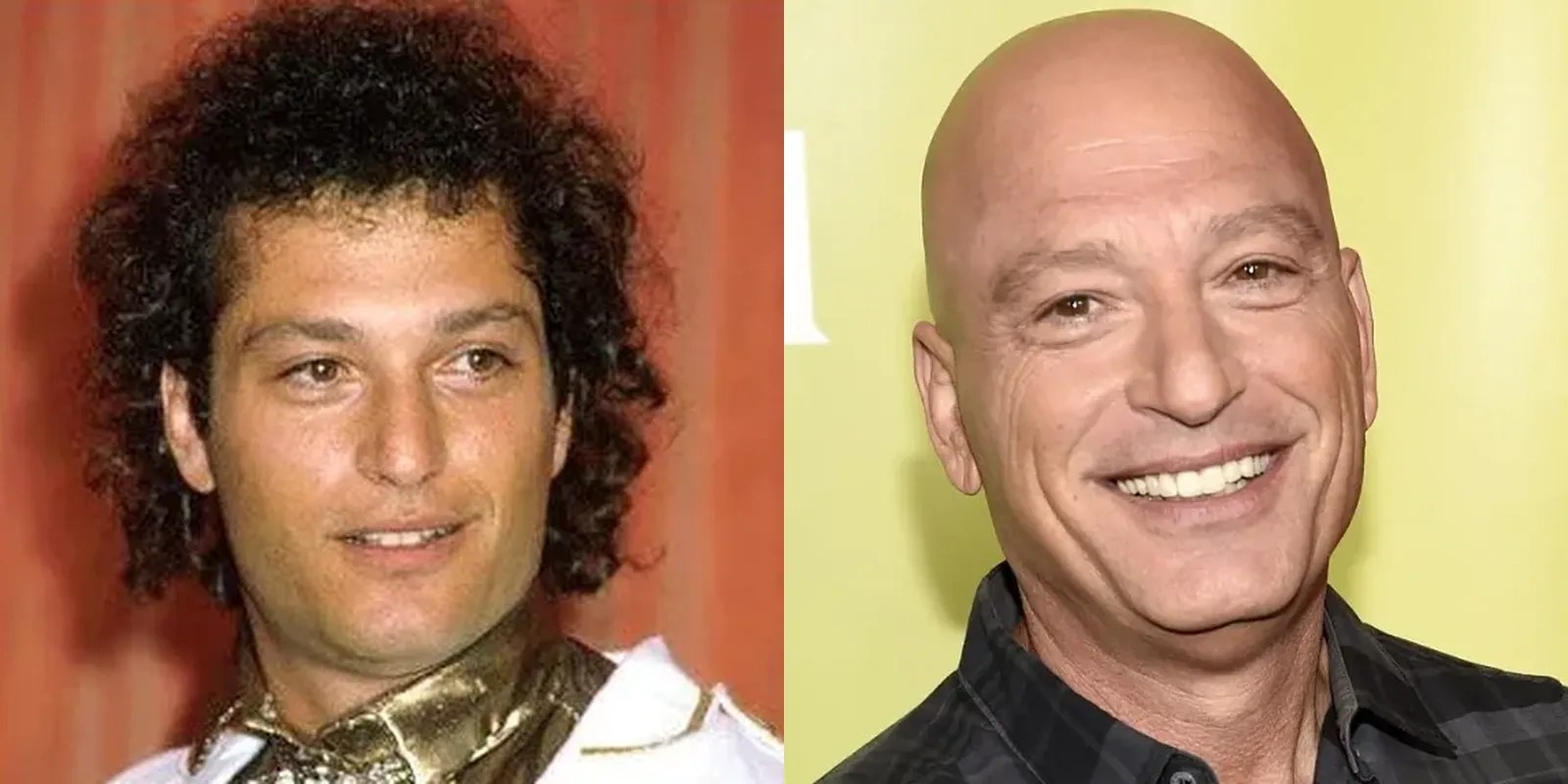 Why Did Howie Mandel Wear A Toupee and Was He Always Bald? Hair System