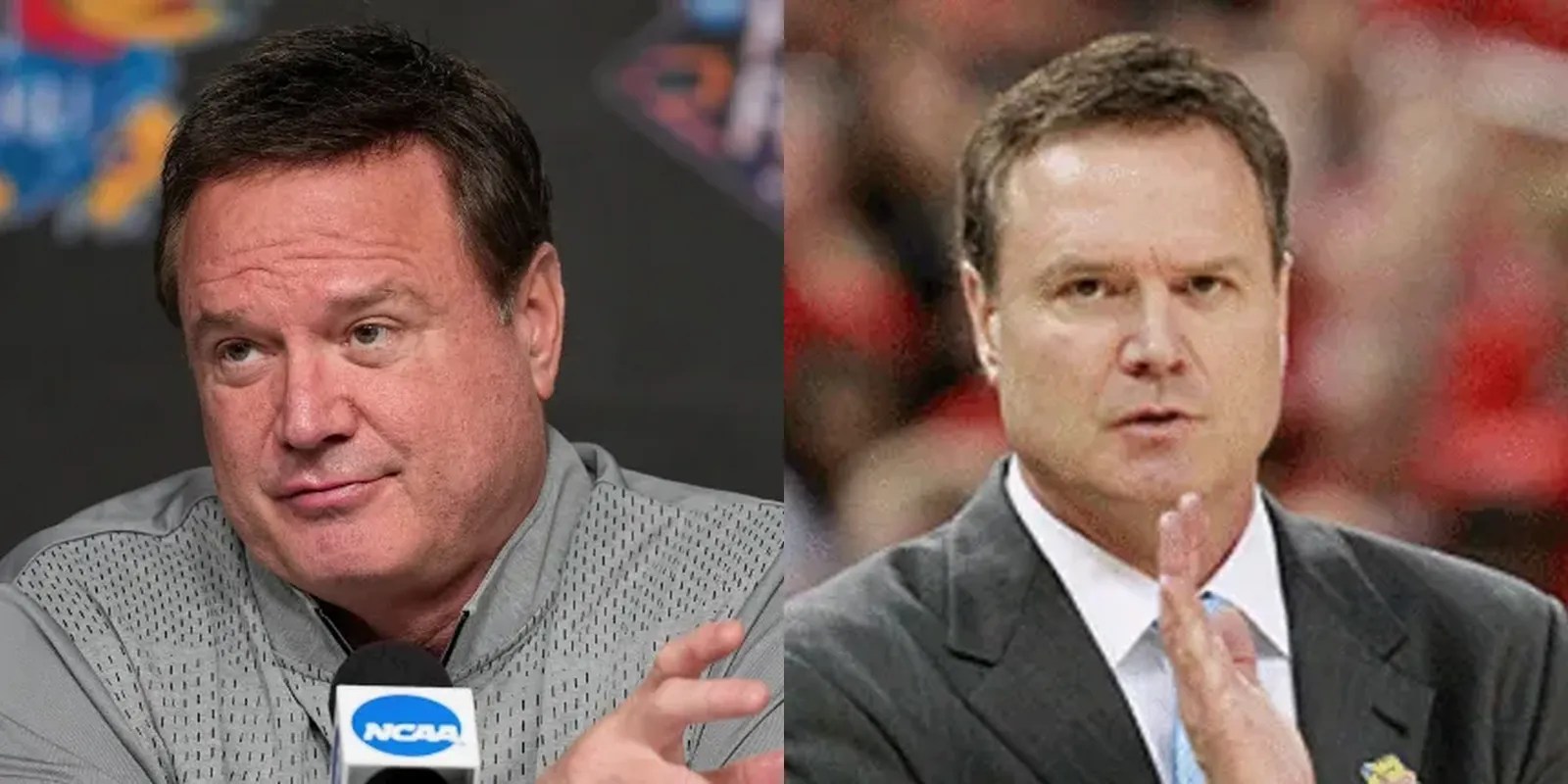 Explore The Bill Self's Mysterious Hairline Hair System