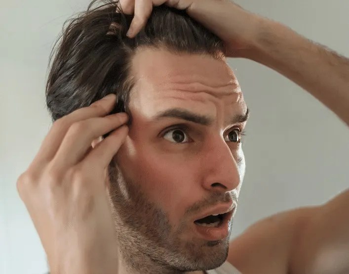 How to Fix Your Hairline? All Methods Included! Hair System