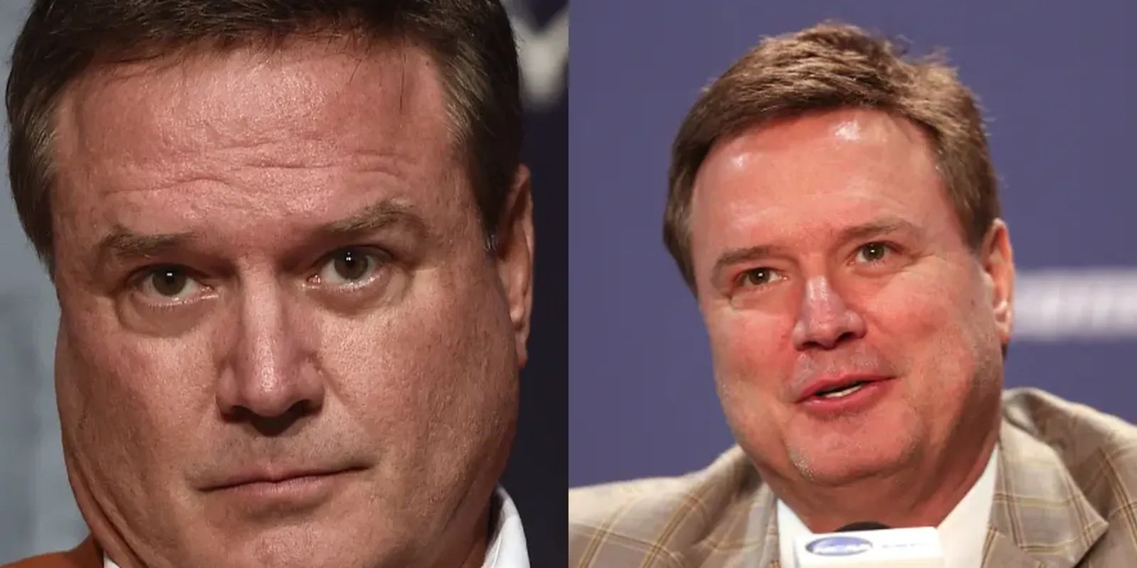 Explore The Bill Self's Mysterious Hairline Hair System