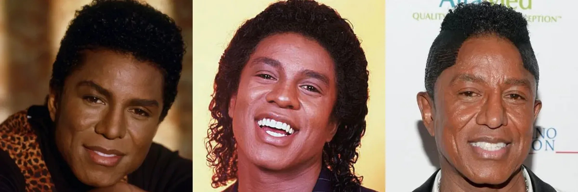 Jermaine Jackson New Hairline (Detailed Look) Hair System