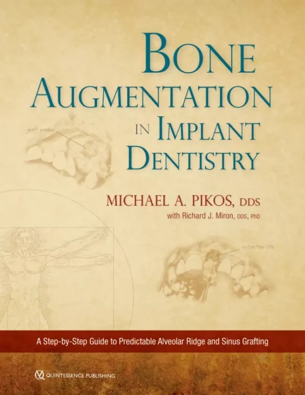 Bone Augmentation in Implant Dentistry A StepbyStep Guide to