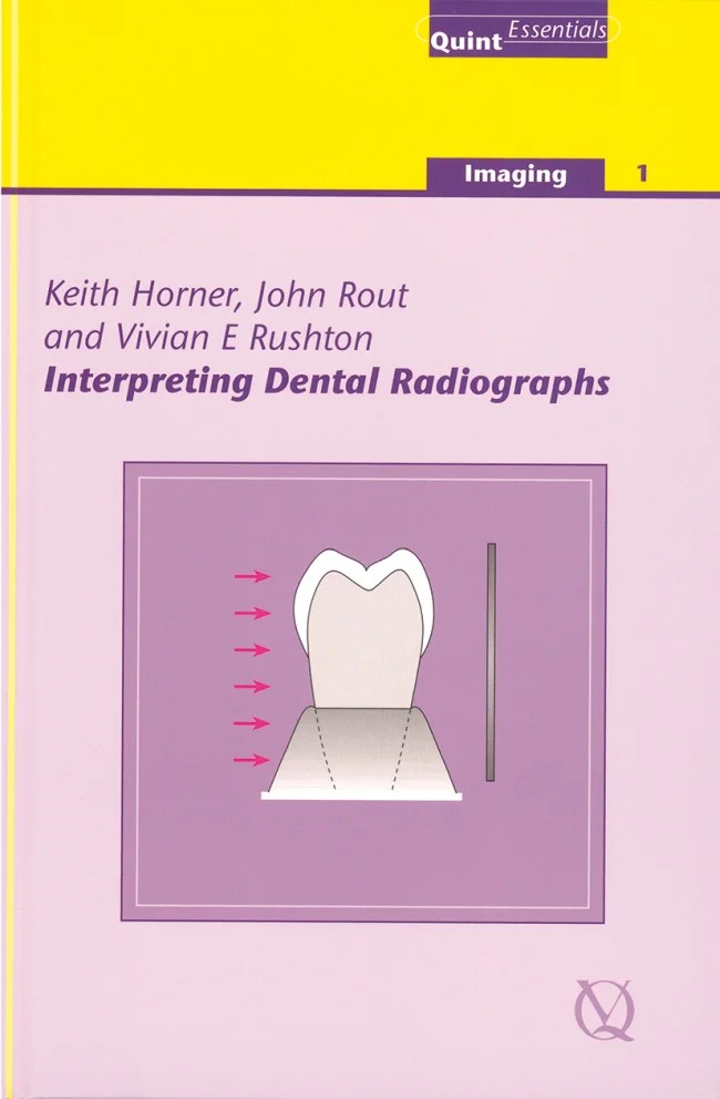 Interpreting Dental Radiographs DocMode Health Technologies Limited