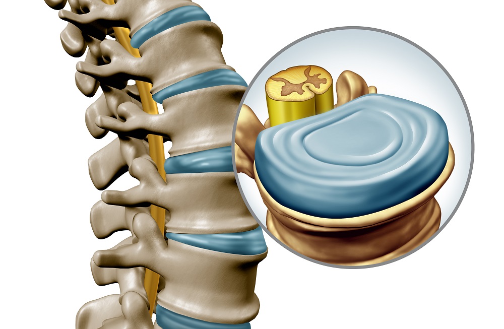 The Intervertebral Disc Facts Santa Cruz Chiropractor