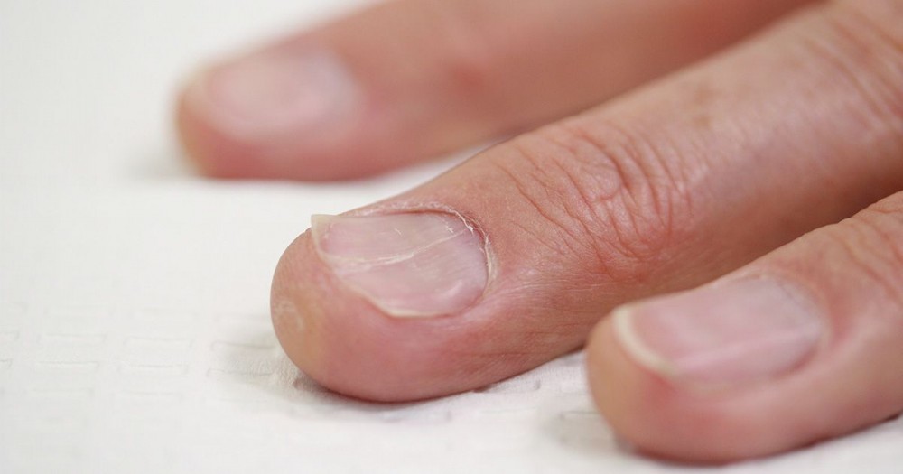 What Your Fingernails Say About Your Health