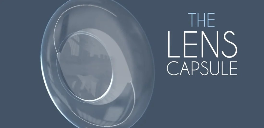 Posterior Capsulotomy Improve Your Vision After Cataract Surgery