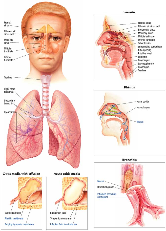 Upper Respiratory Tract Infection Atlas of pathophysiology, 2 Edition