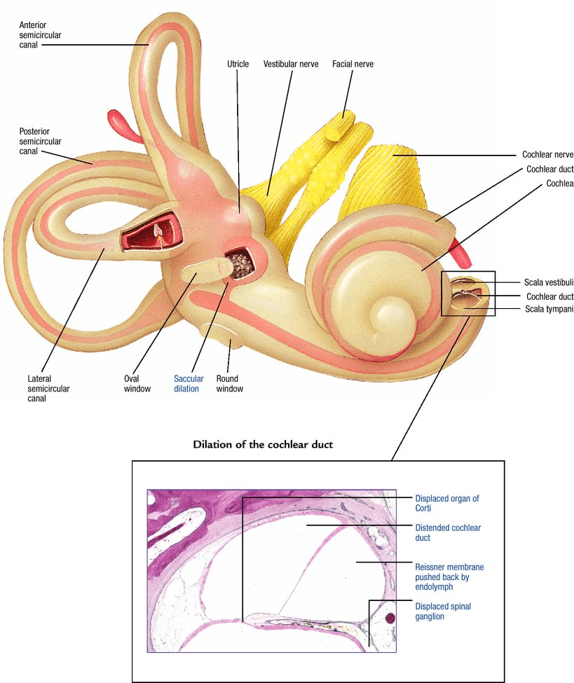 Meniere's disease Atlas of pathophysiology, 2 Edition