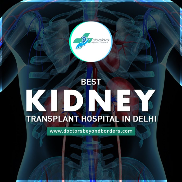 Kindney Transplant Doctors Beyond Borders Reviews of Hospitals and