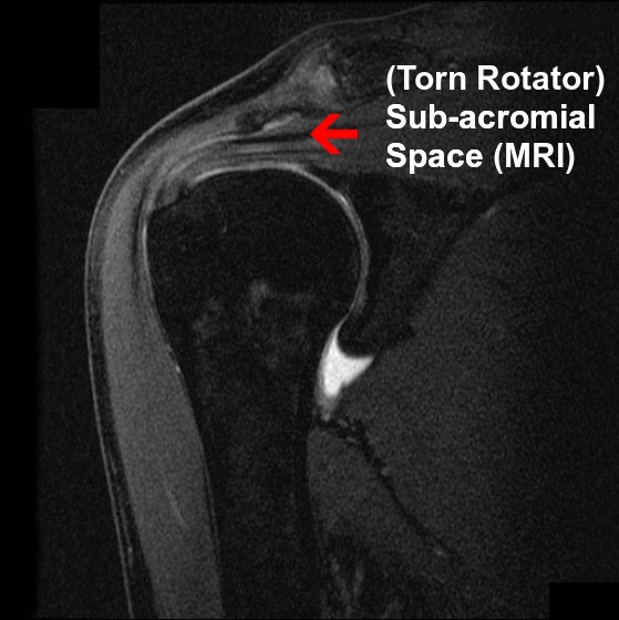 The Many Benefits of Hanging Pain Relief and Better Joint Function