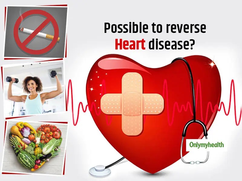 Is it Possible To Reverse Heart Diseases? Health Tips