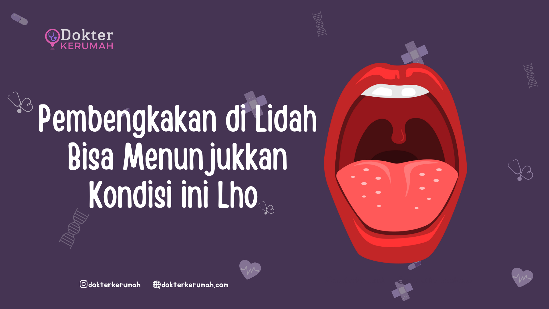 Pembengkakan Pada Lidah Bisa Menunjukkan Kondisi ini Lho! Dokter ke Rumah