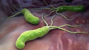 Propolisszal a Helicobacter pylori ellen