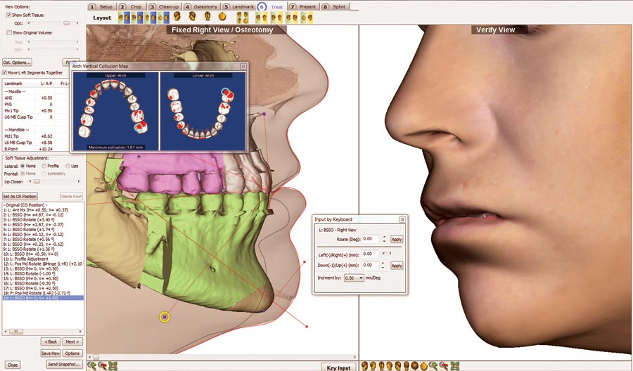 Dolphin 3D Surgery™ Dolphin Imaging Software