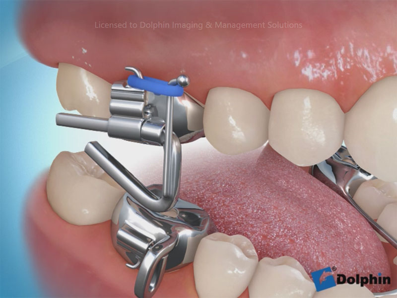 Dolphin Aquarium Surgery & Orthodontics Sample Video Infolab snc