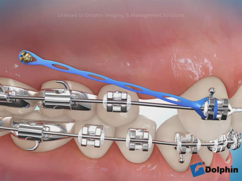 Dolphin Aquarium Surgery & Orthodontics Sample Video Infolab snc