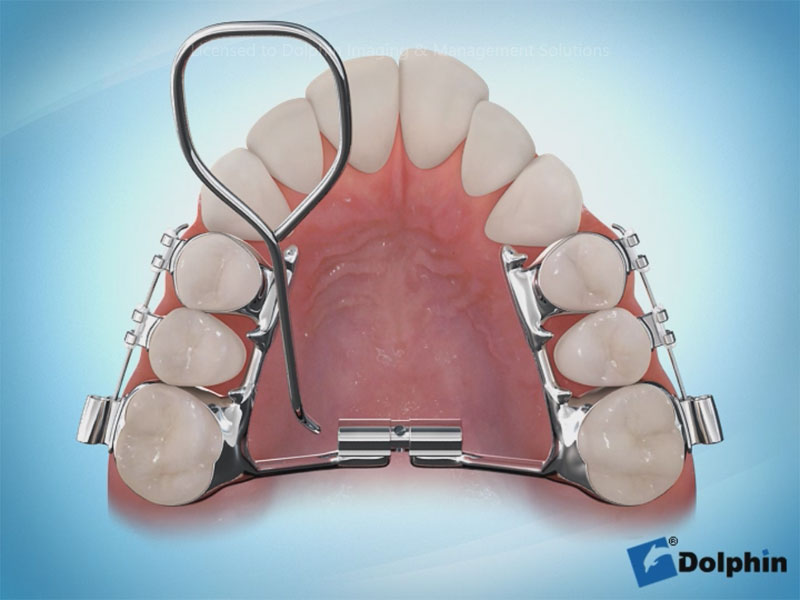 Dolphin Aquarium Surgery & Orthodontics Sample Video Infolab snc