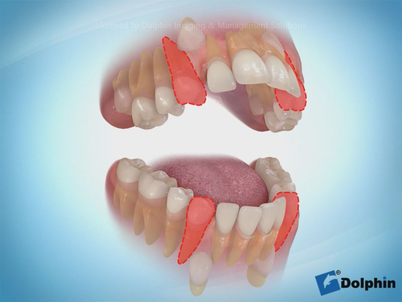 Dolphin Aquarium Surgery & Orthodontics Sample Video Infolab snc