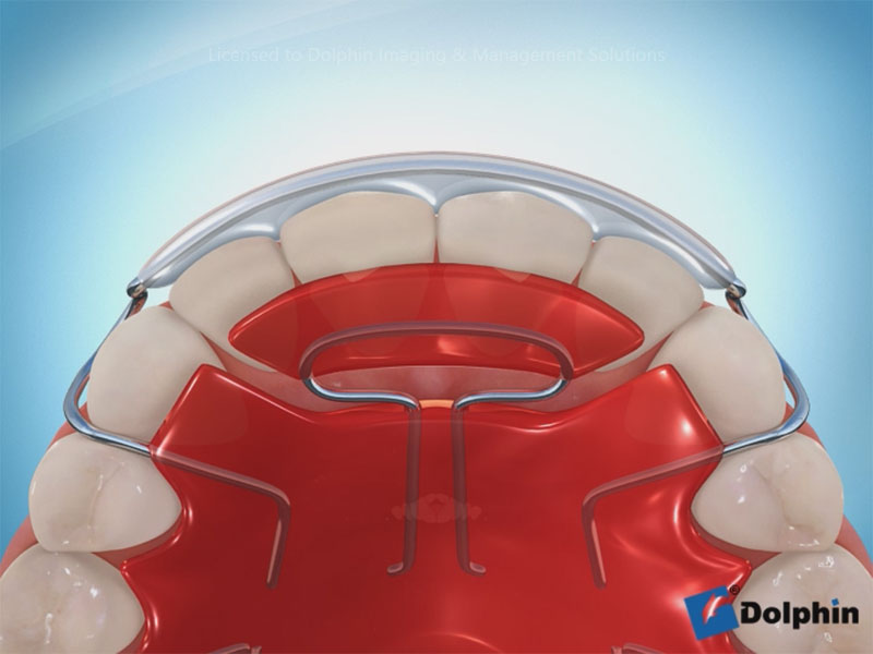 Aquarium Ortho Gallery Dolphin Imaging