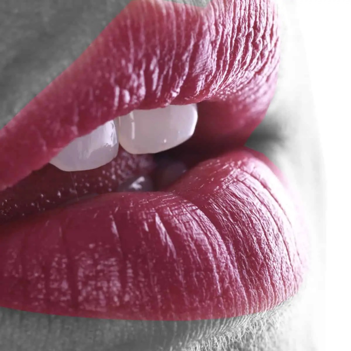 Dermal Fillers Available Here At Doncaster Hill Dental