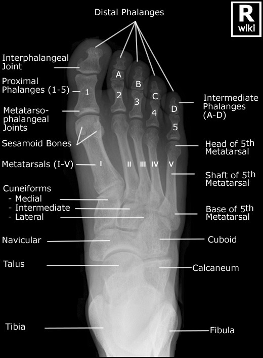 Image result for foot xray anatomy