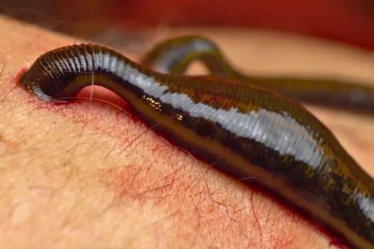 Are Leeches Edible? My Honest Take