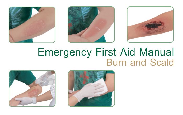 Emergency First Aid Manual Burn and Scald Samitivej