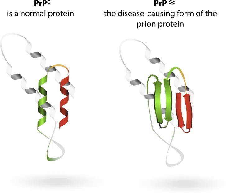How Prions Kill Neurons New Culture System Shows Early Toxicity To Dendritic Spines DoveMed