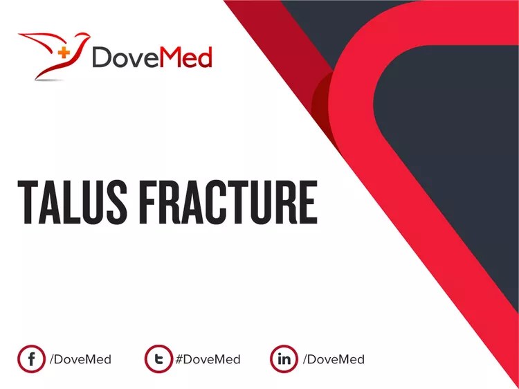 How well do you know Talus Fracture? DoveMed