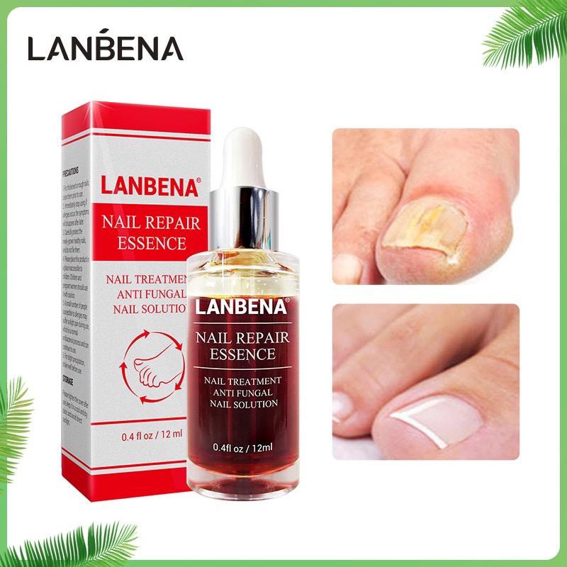Jual MELTBLOWN X LANBENA Nail Repair Serum Vitamin Perawatan Kuku Rusak