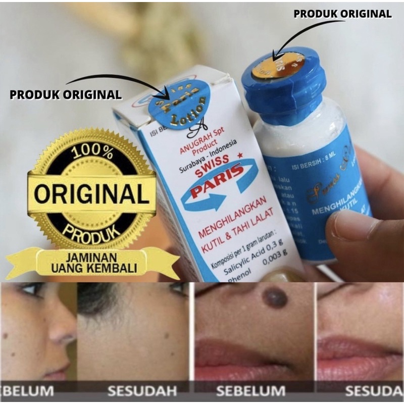 Jual salep penghilang tahi lalat dan kutil cream penghilang tahi lalat