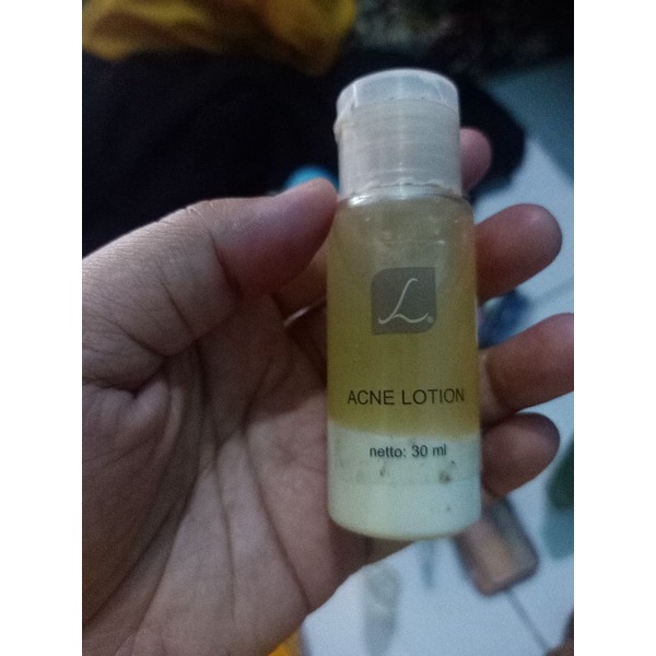 Jual acne lotion larissa Shopee Indonesia