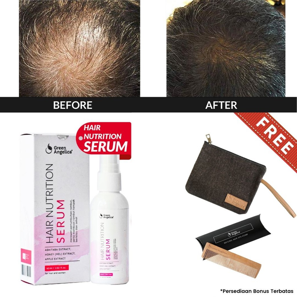 Jual Green Angelica Hair Serum Rambut Rontok, Serum Vitamin Rambut, Serum Rambut Rusak Dan