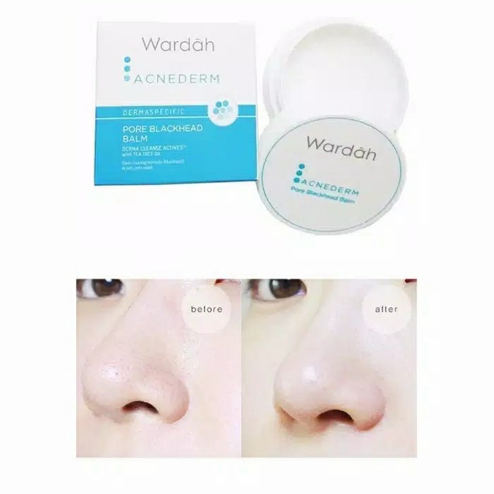 Jual PRIMERFACE WARDAH ACNEDERM PORE BLACKHEAD BALM 20G FACEPRIMER