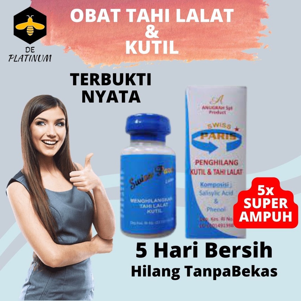 Jual ORIGINAL Lotion Swiss Paris Obat Penghilang Kutil & Tahi Lalat