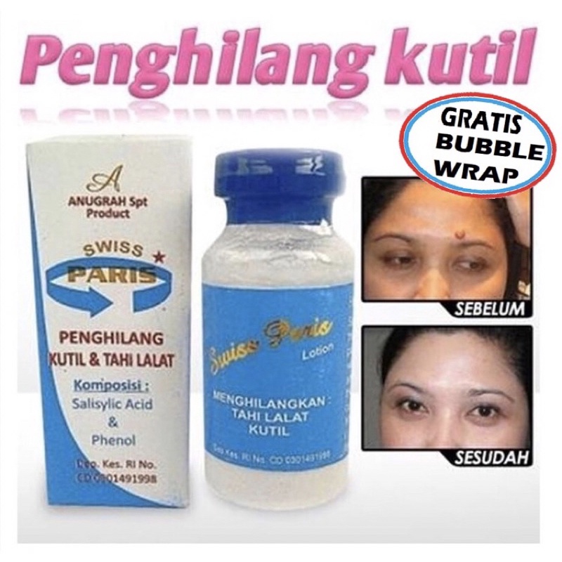 Jual SWISS PARIS LOTION Obat Penghilang KUTIL dan Obat Penghilang TAHI