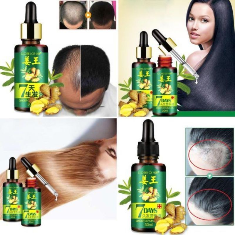 Jual Serum penumbuh rambut herbal 7 days ginger germinal 30ml original Shopee Indonesia