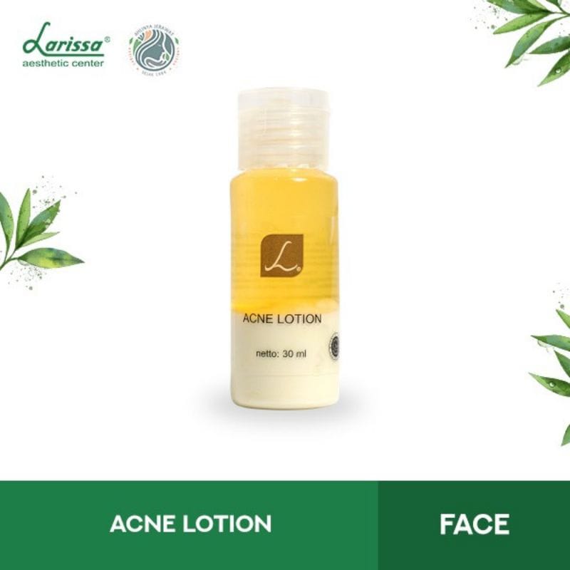 Jual ACNE LOTION LARISSA (OBAT JERAWAT) Shopee Indonesia