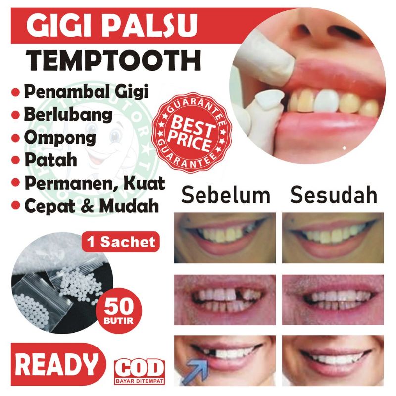 Jual GIGI PALSU SEMENTARA HARGA 50 BUTIR / PENAMBAL GIGI PATAH RENGGANG(04)