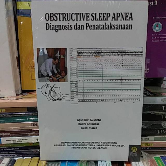 Jual OBSTRUCTIVE SLEEP APNEA DIAGNOSIS DAN PENATALAKSANAAN [ORIGINAL] Shopee Indonesia
