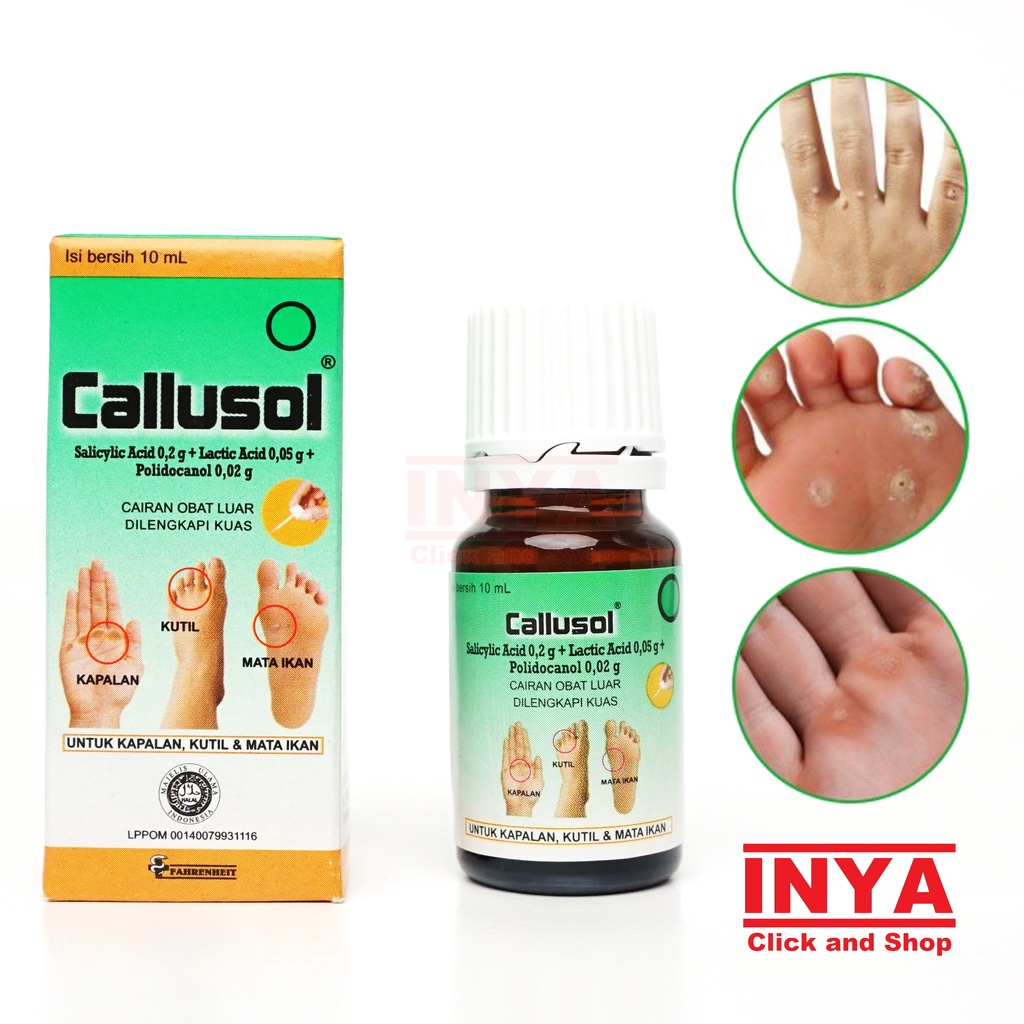 Jual CALLUSOL 10ml Obat Kulit Kapalan Kutil Mata Ikan